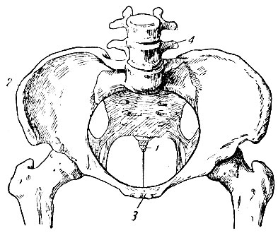 Рис. 1. Нормальный женский таз. 1 - копчик; 2 - подвздошные кости; 3 - лонное сочленение; 4 - позвонки