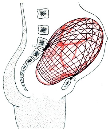 Рис. 1. Беременная матка в сагиттальной проекции (схема). 1 - крестцово-маточные связки; 2 - круглые связки